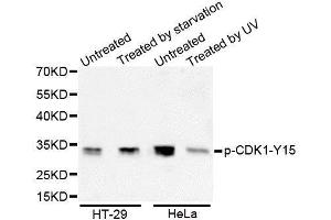 Western Blotting (WB) image for anti-Cyclin-Dependent Kinase 1 (CDK1) (pTyr15) antibody (ABIN3019443) (CDK1 抗体  (pTyr15))