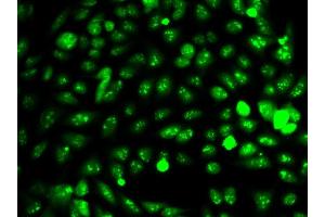Immunofluorescence analysis of HeLa cell using IDH1 antibody. (IDH1 抗体  (AA 1-414))