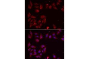 Immunofluorescence analysis of U2OS cells using PDXK antibody. (PDXK 抗体  (AA 1-312))