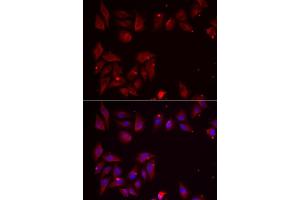 Immunofluorescence analysis of U2OS cells using PDXK antibody. (PDXK 抗体  (AA 1-312))
