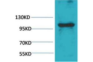 Western Blot (WB) analysis of Pig Skeletal Muscle with eEF1A2 Rabbit Polyclonal Antibody diluted at 1:1,000. (IGFN1 抗体)