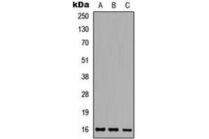 Western blot analysis of Ataxin 7L1 expression in HeLa (A), Raw264. (ATXN7L1 抗体  (Center))