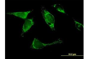 Immunofluorescence of  purified  MaxPab antibody to YARS2 on HeLa cell. (YARS2 抗体  (AA 1-477))