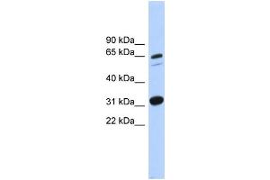 WB Suggested Anti-ITFG3 Antibody Titration: 0. (ITFG3 抗体  (Middle Region))
