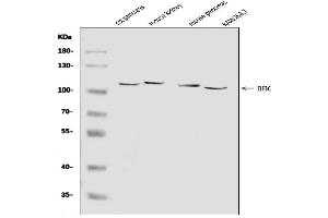 Western blot analysis of EIF3C using anti-EIF3C antibody (ABIN7602528).