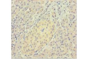 Immunohistochemistry of paraffin-embedded human pancreatic tissue using ABIN7165325 at dilution of 1:100 (LMAN1L 抗体  (AA 26-462))