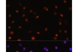 Immunofluorescence analysis of C6 cells using COPS5 Polyclonal Antibody at dilution of 1:100. (COPS5 抗体)