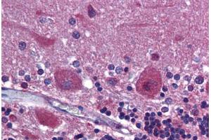 Human Brain, Cerebellum: Formalin-Fixed, Paraffin-Embedded (FFPE) (PDGFRA 抗体  (AA 1035-1053))