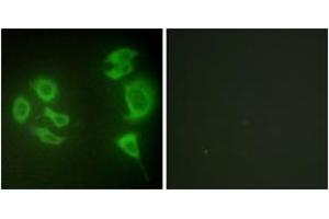 Immunofluorescence analysis of HepG2 cells, using MLTK Antibody. (ZAK 抗体  (AA 701-750))