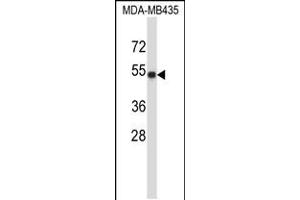 Western blot analysis in MDA-MB435 cell line lysates (35ug/lane). (TUBA3C 抗体  (C-Term))