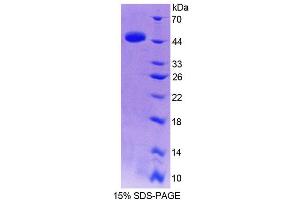 SDS-PAGE analysis of Human TRIP6 Protein. (TRIP6 蛋白)