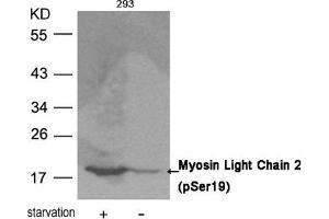 Western blot analysis of extracts from 293 cells untreated or treated with starvation using Myosin Light Chain 2 (Phospho-Ser19) Antibody.