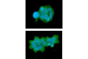 ICC/IF analysis of OSTF1 in MCF7 cells line, stained with DAPI (Blue) for nucleus staining and monoclonal anti-human OSTF1 antibody (1:100) with goat anti-mouse IgG-Alexa fluor 488 conjugate (Green). (OSTF1 抗体)