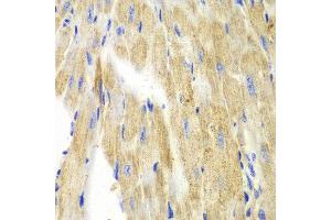Immunohistochemistry of paraffin-embedded mouse heart using KRT19 antibody at dilution of 1:100 (400x lens). (Cytokeratin 19 抗体)