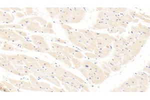 Detection of ALB in Human Cardiac Muscle Tissue using Monoclonal Antibody to Albumin (ALB) (Albumin 抗体)