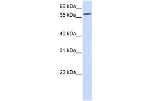 IL1RAPL2 antibody used at 1 ug/ml to detect target protein.