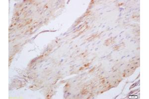Formalin-fixed and paraffin embedded mouse stomach labeled with Anti-Elastin Polyclonal Antibody, Unconjugated (ABIN1386226) at 1:200 followed by conjugation to the secondary antibody and DAB staining (Elastin 抗体  (AA 101-200))