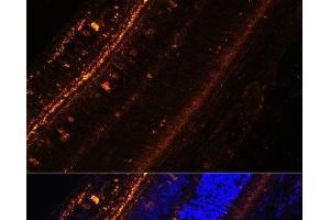 Immunofluorescence analysis of Rat eye using KCNS2 Polyclonal Antibody at dilution of 1:100 (40x lens). (KCNS2 抗体)