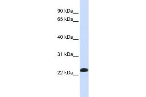 WB Suggested Anti-CAV2 Antibody Titration:  0. (Caveolin 2 抗体  (N-Term))