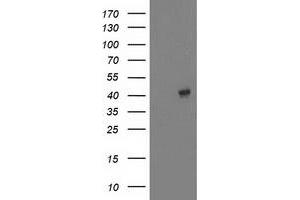 Western Blotting (WB) image for anti-Microtubule-Associated Protein, RP/EB Family, Member 2 (MAPRE2) antibody (ABIN1499320) (MAPRE2 抗体)