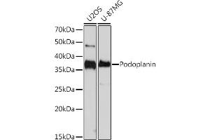 Western blot analysis of extracts of various cell lines, using Podoplanin Rabbit mAb (ABIN7269430) at 1:1000 dilution. (Podoplanin 抗体)