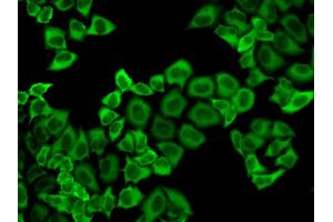 Immunofluorescence analysis of HeLa cell using PRDX2 antibody. (Peroxiredoxin 2 抗体)