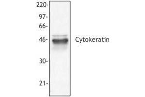 Image no. 1 for anti-pan Keratin (panKRT) antibody (ABIN293953) (pan Keratin 抗体)