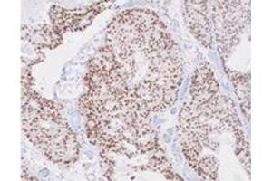 Immunohistochemistry (IHC) image for anti-TAR DNA Binding Protein (TARDBP) (AA 1-260), (N-Term) antibody (ABIN317572) (TARDBP 抗体  (N-Term))