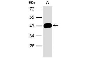 WB Image Sample(30 μg of whole cell lysate) A:A431, 10% SDS PAGE antibody diluted at 1:1000 (SERPINB5 抗体  (Center))