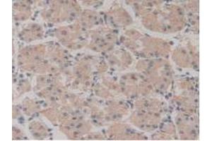 IHC-P analysis of Human Stomach Tissue, with DAB staining. (NUP210 抗体  (AA 1288-1449))