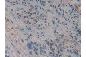 Immunohistochemistry (IHC) image for anti-Cylindromatosis (Turban Tumor Syndrome) (CYLD) (AA 170-338) antibody (ABIN7434896)