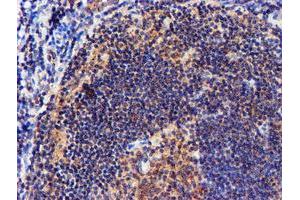 Image no. 5 for anti-NADH Dehydrogenase (Ubiquinone) Complex I, Assembly Factor 7 (NDUFAF7) antibody (ABIN1499667) (NDUFAF7 抗体)