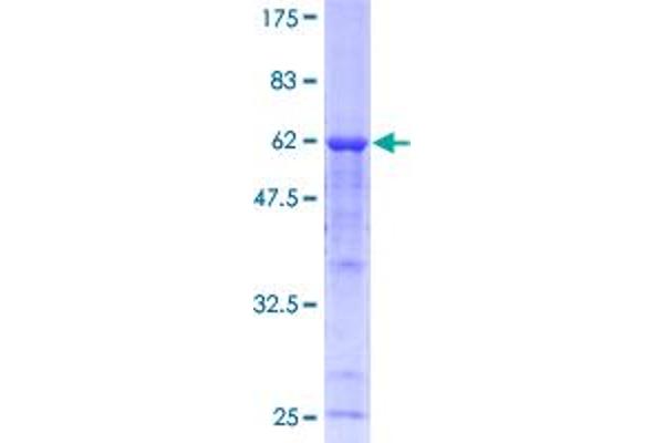 Calpain 3 Protein (CAPN3) (AA 1-309) (GST tag)