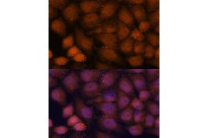 Immunofluorescence analysis of HeLa cells using CEP85 antibody (ABIN7266281) at dilution of 1:100. (CEP85 抗体  (AA 130-430))