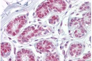 Immunohistochemistry (IHC) image for anti-Apurinic/Apyrimidinic Endonuclease 1 (APEX1) (AA 36-52) antibody (ABIN959854)