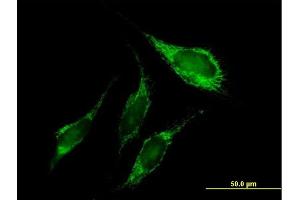 Immunofluorescence of purified MaxPab antibody to PNPT1 on HeLa cell. (PNPT1 抗体  (AA 1-783))