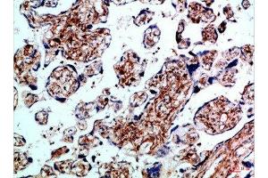 Immunohistochemical analysis of paraffin-embedded Human-placenta, antibody was diluted at 1:100 (BMPR1B 抗体  (AA 21-70))