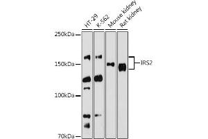 Western blot analysis of extracts of various cell lines, using IRS2 antibody (ABIN6128094, ABIN6142544, ABIN6142545 and ABIN6223949) at 1:500 dilution. (IRS2 抗体  (AA 510-650))