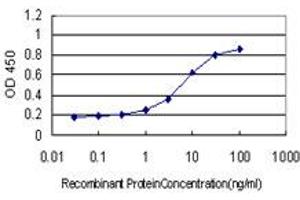 Detection limit for recombinant GST tagged SDSL is approximately 0. (SDSL 抗体  (AA 1-329))
