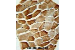 SYNCI Antibody (N-term) immunohistochemistry analysis in formalin fixed and paraffin embedded human skeletal muscle followed by peroxidase conjugation of the secondary antibody and DAB staining. (Syncoilin 抗体  (N-Term))