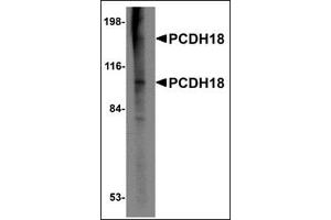 Western blot analysis of PCDH18 in Raji cell lysate with this product at 2 μg/ml. (PCDH18 抗体  (N-Term))