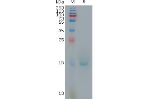 SDS-PAGE (SDS) image for Interleukin 10 (IL10) (AA 19-178) protein (His tag) (ABIN7491255)