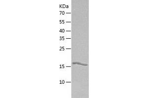 Western Blotting (WB) image for Guanylate Kinase 1 (GUK1) (AA 1-197) protein (His tag) (ABIN7123245) (GUK1 Protein (AA 1-197) (His tag))