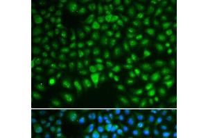 Immunofluorescence analysis of HeLa cells using DLGAP5 Polyclonal Antibody