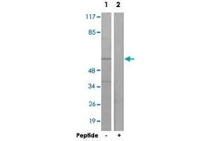 Western blot analysis of extracts from K-562 cells, using ACVRL1 polyclonal antibody . (ACVRL1 抗体)