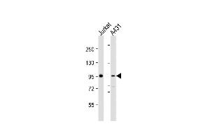 All lanes : Anti-NCSTN Antibody (N-Term) at 1:2000 dilution Lane 1: Jurkat whole cell lysates Lane 2: A431 whole cell lysates Lysates/proteins at 20 μg per lane. (Nicastrin 抗体  (AA 99-133))