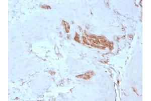 Immunohistochemistry (IHC) image for anti-Spectrin alpha Chain, Brain (SPTAN1) (AA 2351-2475) antibody (ABIN6940647)