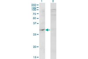 Western Blot analysis of DAPP1 expression in transfected 293T cell line by DAPP1 monoclonal antibody (M04), clone 1E1. (DAPP1 抗体  (AA 1-280))
