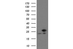 Western Blotting (WB) image for anti-Prefoldin Subunit 3 (PFDN3) antibody (ABIN1501703) (VBP1 抗体)