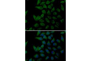 Immunofluorescence analysis of U20S cell using PLOD2 antibody. (PLOD2 抗体)